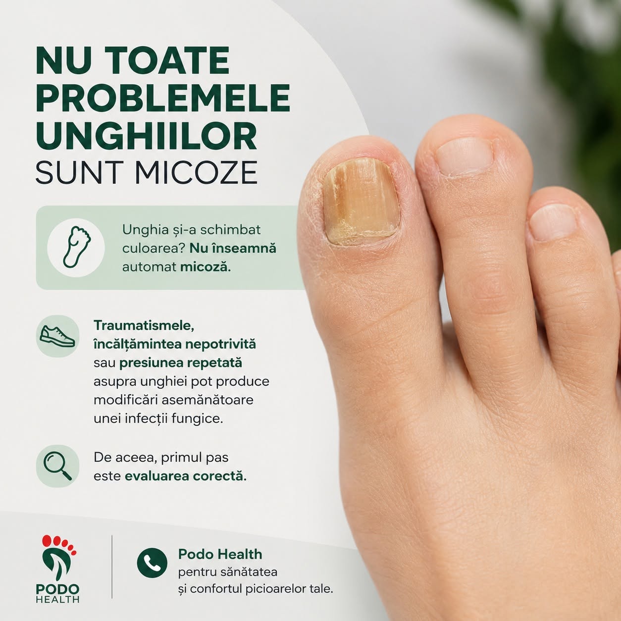 Nu toate problemele unghilor sunt micoze